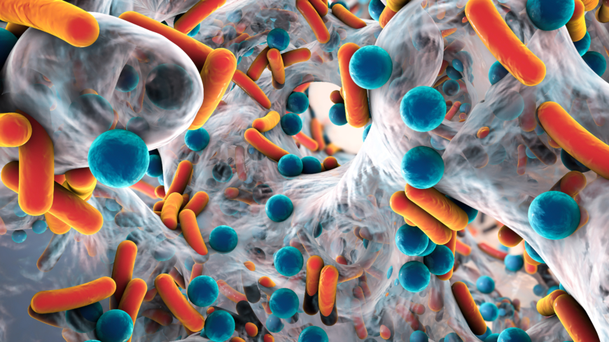 Världshälsoorganisationen WHO klassar antibiotikaresistens som ett av de tio största hoten mot människors hälsa globalt.  Foto: Shutterstock